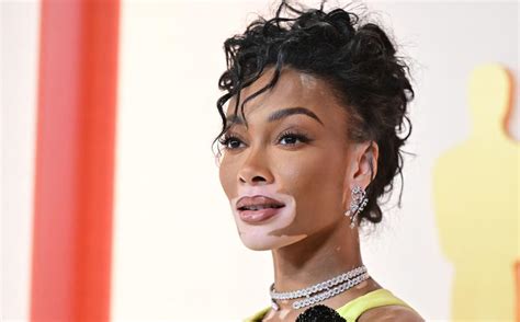 winnie harlow nude|Winnie Harlow Poses Nude to Show Beauty of Her Vitiligo